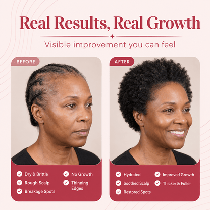 BaliAga Kemiri Natural Hair Growth Oil - Bali Aga Beauty