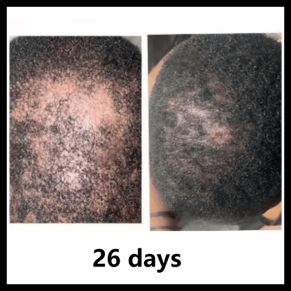 BaliAga Kemiri Oil – Natural Hair Growth Oil | Helps Hair Grow Longer, Stronger & Healthier - Bali Aga Beauty