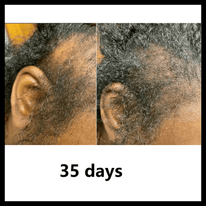 BaliAga Kemiri Oil – Natural Hair Growth Oil | Helps Hair Grow Longer, Stronger & Healthier - Bali Aga Beauty