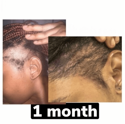 BaliAga Kemiri Oil – Natural Hair Growth Oil | Helps Hair Grow Longer, Stronger & Healthier - Bali Aga Beauty