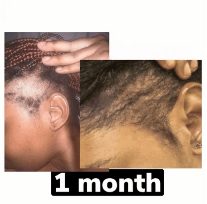 BaliAga Kemiri Oil – Natural Hair Growth Oil | Helps Hair Grow Longer, Stronger & Healthier - Bali Aga Beauty