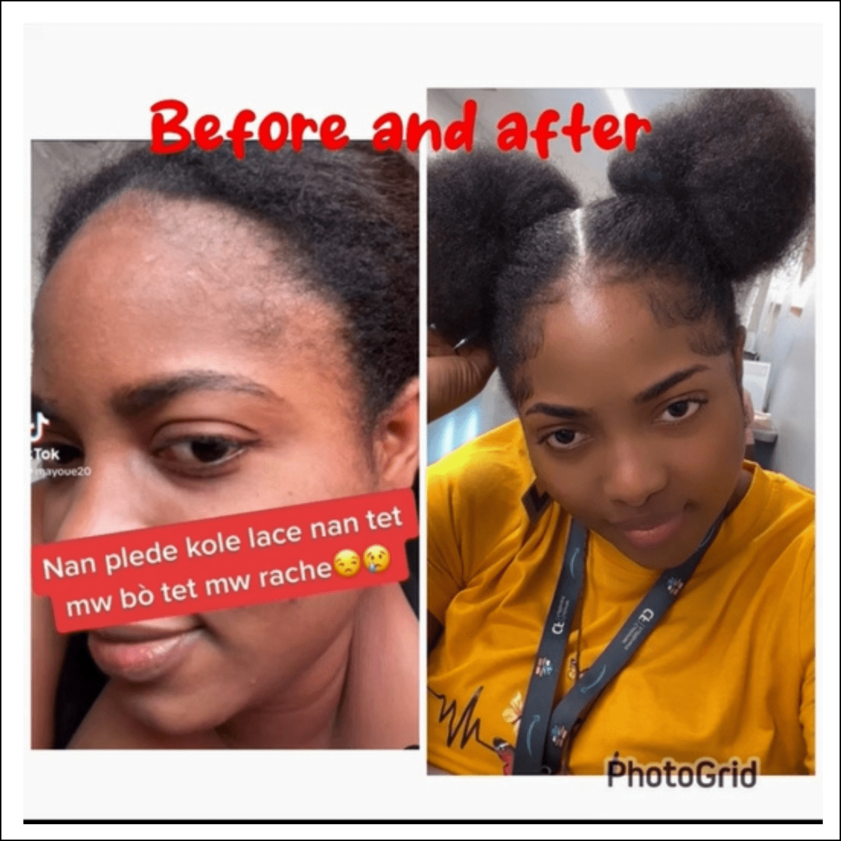 Lwil pou fè cheve grandi BaliAga Kemiri – Lwil natirèl | Ankouraje kwasans cheve - Bali Aga Beauty