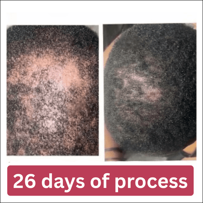 Lwil pou fè cheve grandi BaliAga Kemiri – Lwil natirèl | Ankouraje kwasans cheve - Bali Aga Beauty