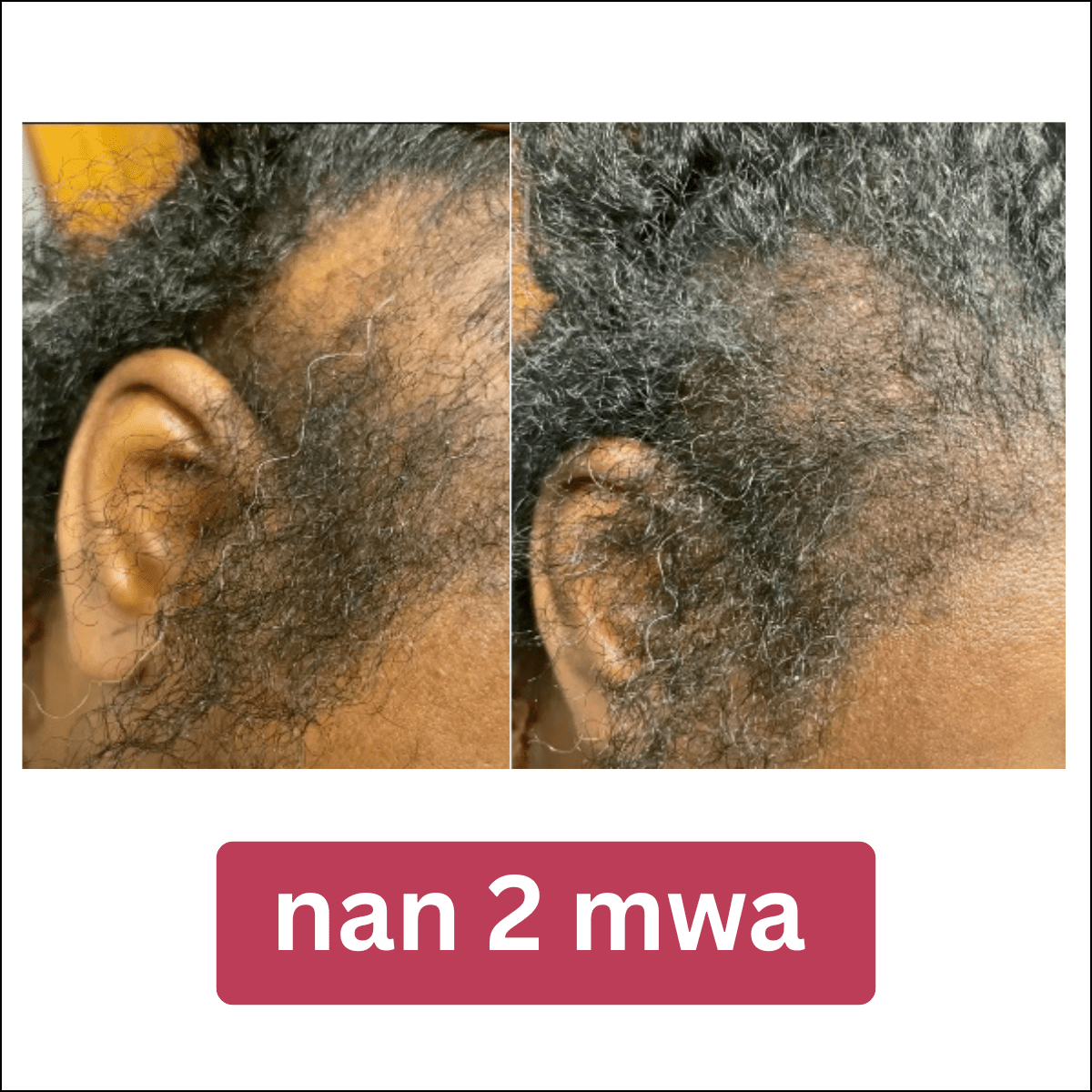 Lwil pou fè cheve grandi BaliAga Kemiri – Lwil natirèl | Ankouraje kwasans cheve - Bali Aga Beauty
