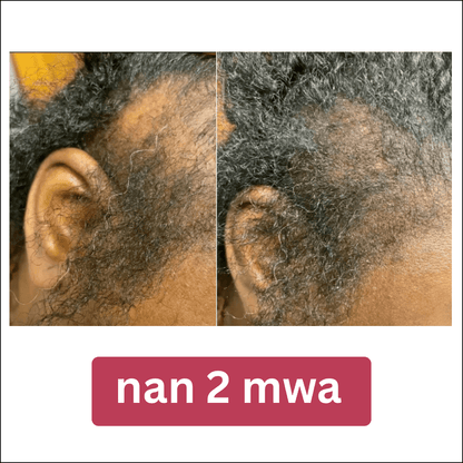 Lwil pou fè cheve grandi BaliAga Kemiri – Lwil natirèl | Ankouraje kwasans cheve - Bali Aga Beauty
